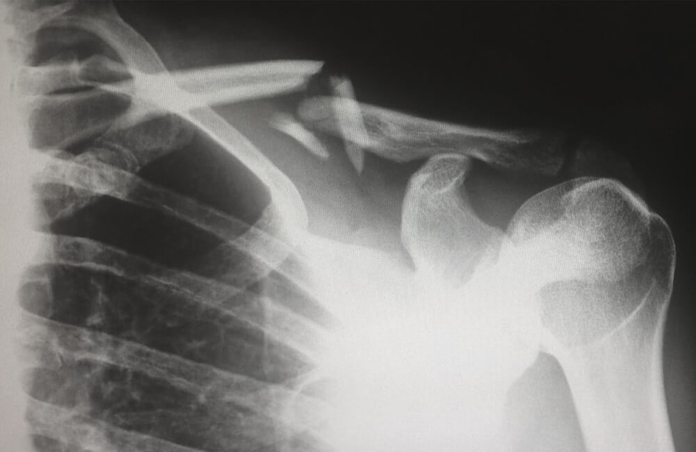 What Innovations Could Shape the Future of Orthopaedics?